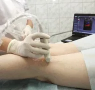 Триплексное сканирование сосудов