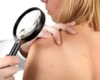 Почему родинки превращаются в раковые опухоли?