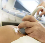 Ультразвуковая допплерография сосудов плода и матки