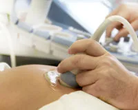 Ультразвуковая допплерография сосудов плода и матки