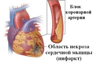 5761748c64d58