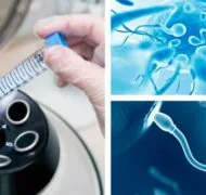 Диагностика мужского бесплодия в Ейске