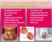 Основные заболевания щитовидной железы
