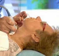 Узловой зоб: симптомы и диагностика