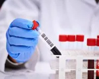 Цитологические исследования для диагностики рака