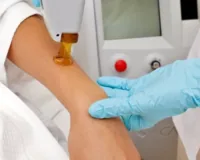 Удаление подкожных новообразований — атеромы, липомы. 