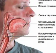 Оказание помощи при анафилактическом шоке