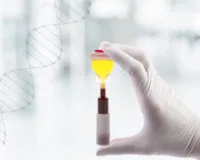 PRP-терапия по методике Ycellbio для лечения суставов